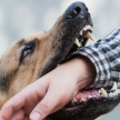 В Набережных Челнах бойцовская собака напала на девочку